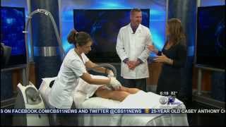 CBS News interviews Advanced Skin Fitness about using Velashape to reduce cellulite [upl. by Kihtrak]