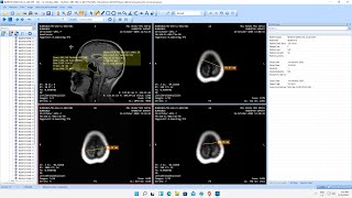 How to copy a DICOM image to clipboard [upl. by Graniela419]