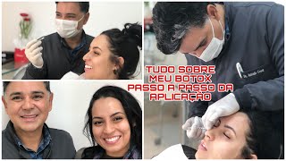 BOTOX NA TESTA  SERÁ QUE DÓI MUITO  PROCEDIMENTO COMPLETO [upl. by Ojyllek]