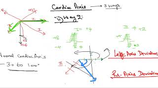 ECG Part 3Cardiac Axis in detail [upl. by Yrocaj]