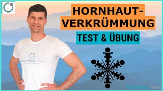 HORNHAUTVERKRÜMMUNG Wegtrainieren  Test Übung amp Training [upl. by Llekcor303]