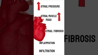 What causes Atrial Fibrillation medicine cardiology medical [upl. by Annovahs742]