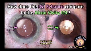 CataractCoach 1218 JampJ Eyhance compared to the Alcon Vivity IOL [upl. by Mozes685]