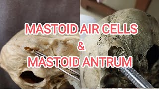 Mastoid air cells and mastoid antrum [upl. by Rehotsirhc]