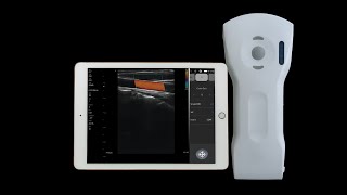 64channel high quality handheld ultrasound [upl. by Girardi187]