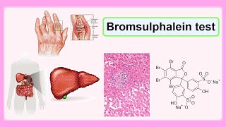 bromsulphalein test [upl. by Ecirtnahc489]