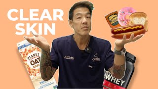 How your Diet and Gym Habits are causing Acne  Dr Davin Lim [upl. by Millhon]