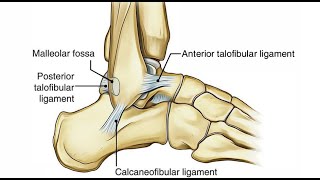 Sprain vs Strain Whats the Difference [upl. by Airamalegna815]