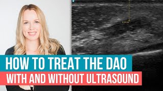 DAO Depressor Anguli Oris Treatment Tips with and without Ultrasound [upl. by Anirtep466]