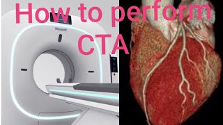 HOW TO PERFORM Cardiac Angiography [upl. by Yeltnarb876]