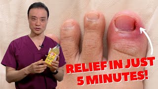 6 HOME REMEDIES To Treat A PAINFUL Ingrown Nail  Dr Kim [upl. by Denise]