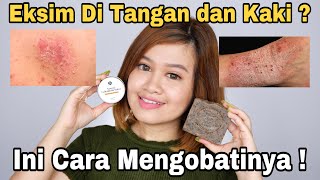 EKSIM DI TANGAN DAN KAKI INI CARA MENGOBATINYA  BIOTALK COFFEE SCRUB  NATURAL CALENDULA SALVE [upl. by Brear]