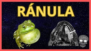 RÁNULA 🐸 Hallazgos Radiológicos [upl. by Yeroc880]