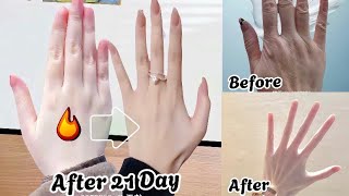 Top Exercise for Girls  The best way to slim your fingers  Latest slim finger exercises [upl. by Atat]