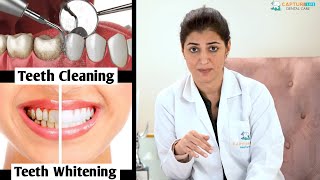 What is the difference between Teeth Cleaning and Whitening Our expert dentist Dr Namrata explains [upl. by Ailemaj]