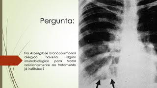 Aspergilose Broncopulmonar alérgica haveria algum imunobiológico além do tratamento já instituído [upl. by Ion]