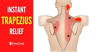 How to Relieve Trapezius Pain FOR GOOD [upl. by Gahan]