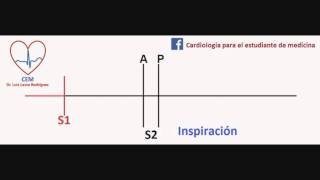 Auscultación del desdoblamiento fisiologico del 2do ruido [upl. by Niatirb]