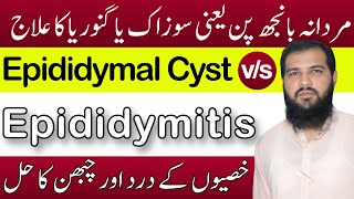 Epididymitis treatment in hindi  Epididymal cyst treatment  sozak Ka ilaj  Epididymitis [upl. by Leik83]