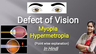 Defects of Vision  Myopia  Hypermetropia  Presbyopia  In Hindi [upl. by Laughton817]