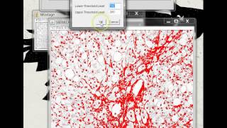 Quantifying Stained Liver Tissue Area Using ImageJ [upl. by Anaed]