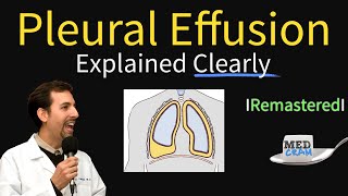 Pleural Effusions  Causes Diagnosis Symptoms Treatment [upl. by Eelyram]