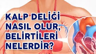 Kalp Deliği Nasıl Olur ve Belirtileri Nelerdir anomali tedavi sağlık [upl. by Skill542]