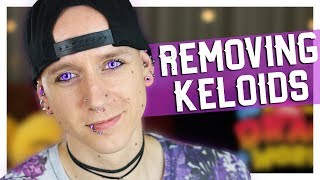 Piercing Keloids Bumps amp Hypertrophic Scars  Piercing FAQ 18  Roly [upl. by Shep821]