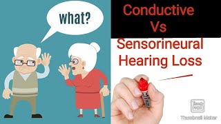 Difference Between Conductive and Sensorineural Hearing Loss  Hand Made Notes [upl. by Arihday103]