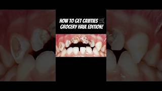 How to get Cavities Or not to get cavities [upl. by Rosio]