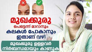 മുഖക്കുരു Acne Pimples പെട്ടെന്ന് മാറാനും കലകൾ പോകാനും ഇതാണ് വഴി [upl. by Norabal]