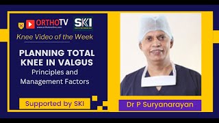 Planning Total Knee in valgus deformity  Dr P Suryanarayan [upl. by Ylimme]