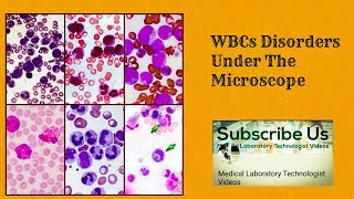 WBC Disorders Under The Microscope [upl. by Aliekat]