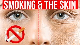 8 skin signs of SMOKING [upl. by Yelsnya]