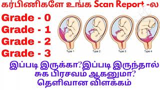 Placenta Grade 0placenta Grade 1 Grade 2Grade 3 என்றால் என்னPlacenta maturity grading in tamil [upl. by Akiehsal]