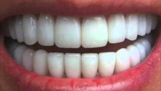 Get Perfectly Straight Teeth―∎ affirmations  Cure Overbite Underbite amp Crossbite [upl. by Liryc]