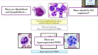 Patients Course Heme Macrocytosis Key Derivatives and embedded questions Part 1 [upl. by Sammy551]