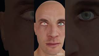 Chemosis anatomy humanbody beautiful humananatomyandphysiology humananatomy humanbiologyshorts [upl. by Atsirak]