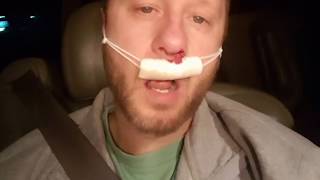 Me on pain medication after surgery Deviated septum repair [upl. by Arrais]