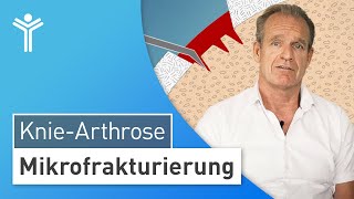 KnieArthrose vorbeugen Mikrofrakturierung bei Knorpelschäden am Knie [upl. by Aneer363]