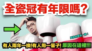 【注意！】全瓷冠有使用年限嗎？十年一換的說法有根據嗎？ [upl. by Joan]