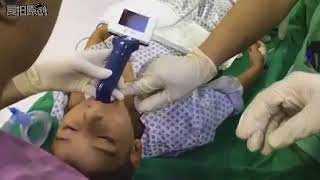 Video Laryngoscope Intubation in Children [upl. by Idelia178]