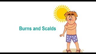 Burns and Scalds first Aid [upl. by Domonic]