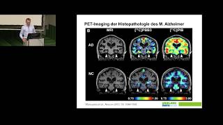 Neurobiologische Grundlagen psychischer Störungen [upl. by Ruckman]