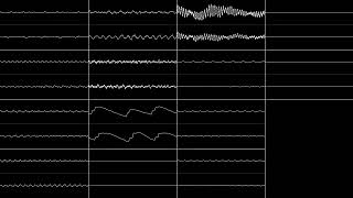 Skaven  Bejeweled 2 Theme amp Autonomous V2 Oscillioscope View [upl. by Beret599]