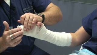 Splint Workshop 3  Ulnar Gutter Splint [upl. by Adiol]