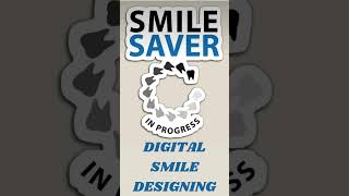 SMILE DESIGN TREATMENT smiledesign smiledesigner smiledentist bestdentalclinic dentist [upl. by Adnorehs]