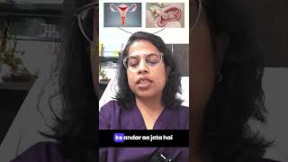 Understanding Ectopic Pregnancy in Hindi [upl. by Bradshaw]