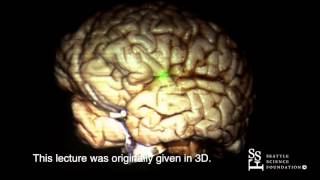 The Brain Surface Sulci amp Gyri by Guilherme Carvalhal Ribas MD [upl. by Juley]