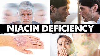 Strange amp Weird Niacin B3 Deficiency Signs and Symptoms [upl. by Yrrah]